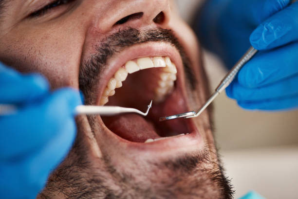 Best Knocked-Out Tooth Emergency  in Paducah, KY